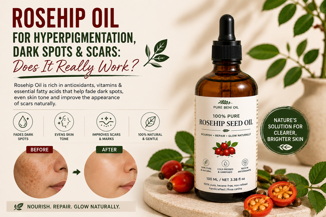 Rosehip Seed Oil for dark spots, hyperpigmentation and scars – Pure Beni Rosehip Oil helps improve skin tone, nourish skin and support a radiant complexion.