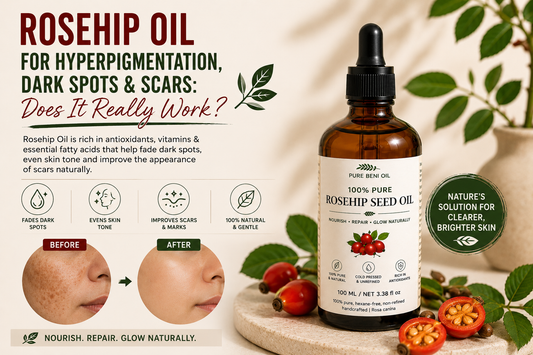 Rosehip Seed Oil for dark spots, hyperpigmentation and scars – Pure Beni Rosehip Oil helps improve skin tone, nourish skin and support a radiant complexion.