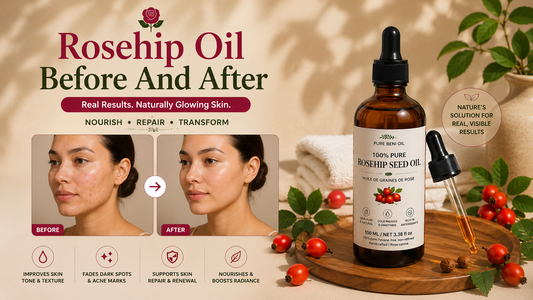 Rosehip Oil Before And After: What To Expect And When