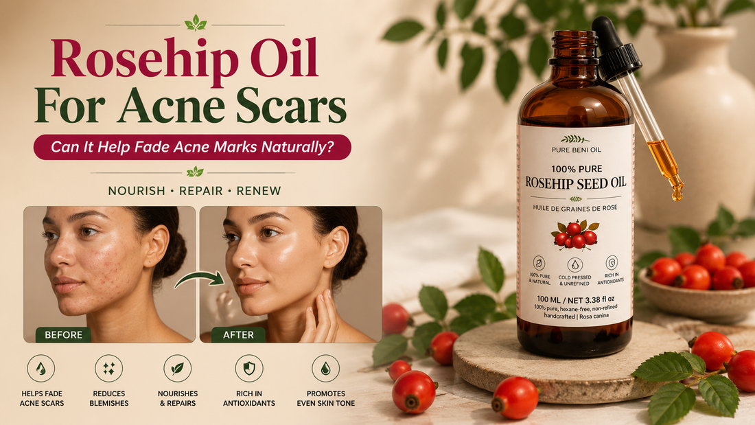 Rosehip oil for acne scars before and after results natural facial oil for fading blemishes and post acne marks