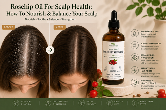 Rosehip oil scalp treatment applied to dry scalp — improved scalp appearance and reduced visible flakes