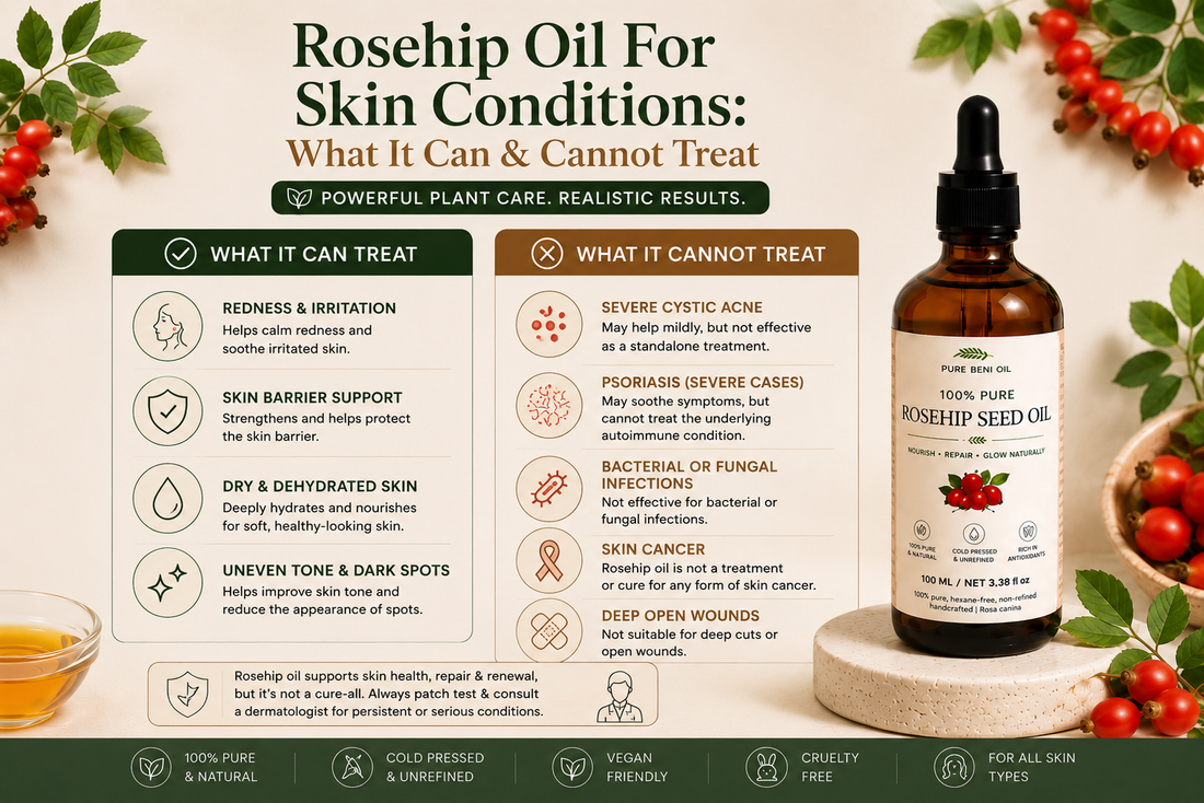 Pure Beni Rosehip Oil skincare infographic showing benefits for skin conditions, helping soothe redness, hydrate dry skin, strengthen the skin barrier, support skin renewal and protect with natural antioxidants.