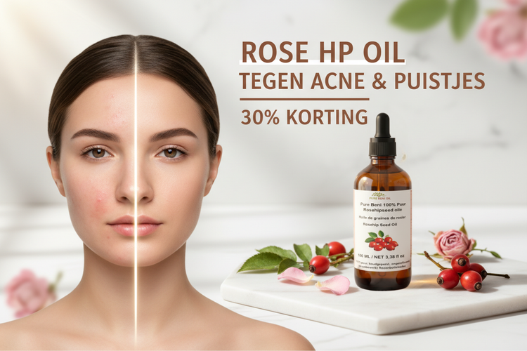  "Rose HP Oil tegen acne en puistjes collectie - zuivere huid"