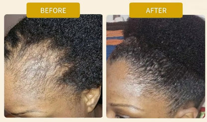 Thrive Haargroeiolie – Natuurlijke verzorging voor sterker, gezonder haar