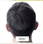 After — visibly thicker hair at the crown after using PURE BÉNI Hair Growth Duo