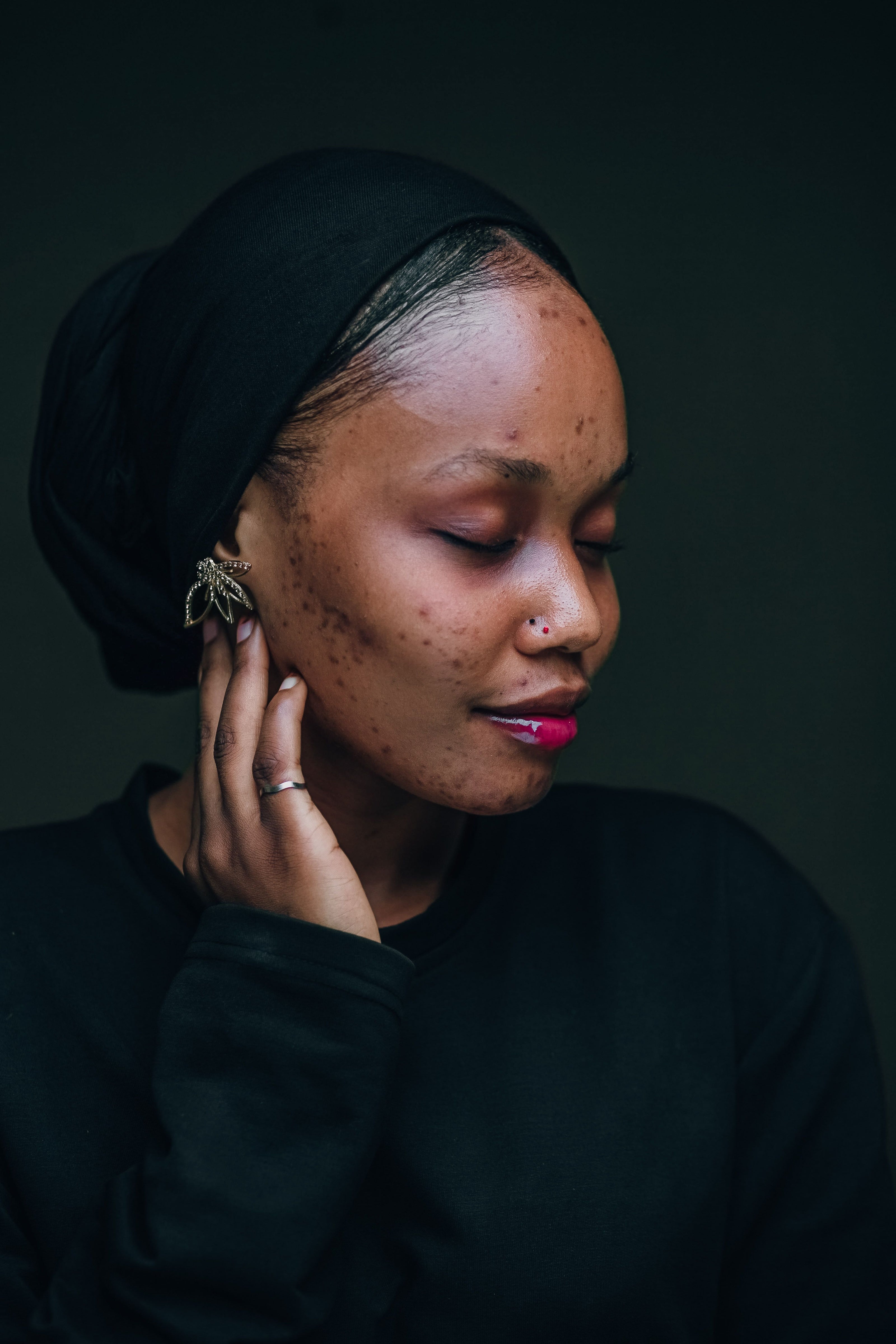 Dark spots on skin — rosehip oil brightening treatment
