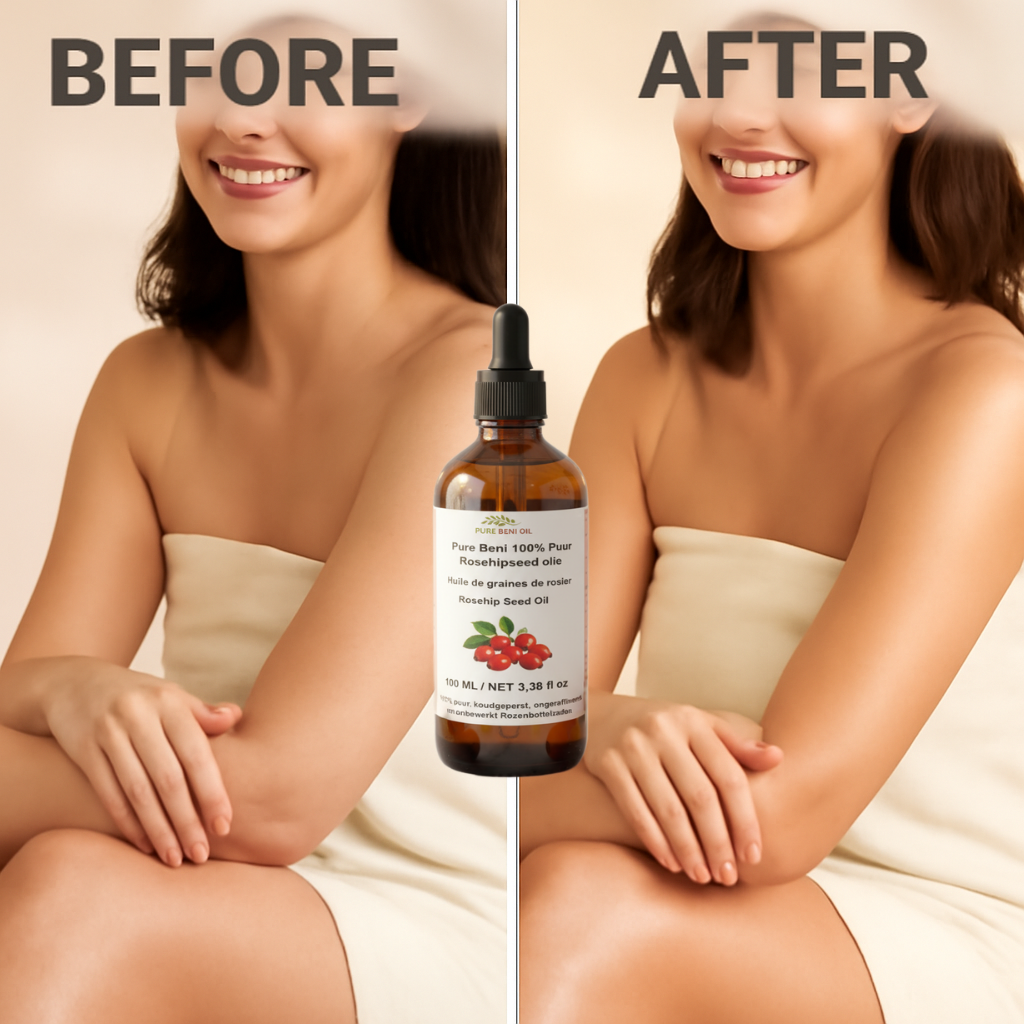 "Pure Beni Natural Rosehip Oil moisturizer for body"