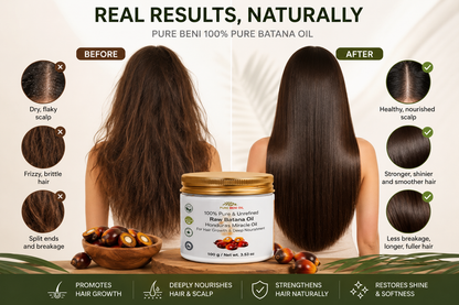Before
Dry, flaky scalp
Frizzy, brittle hair
Split ends and breakage
After
Healthy, nourished scalp
Stronger, shinier and smoother hair
Less breakage, longer and fuller hair
Bottom of image
Promotes hair growth
Deeply nourishes hair and scalp
Strengthens hair naturally
Restores shine and softness