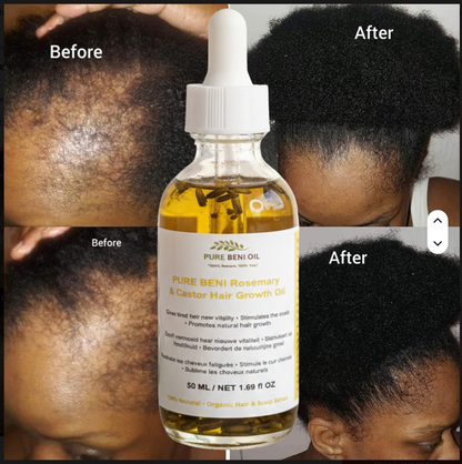 "PURE BÉNI Rosemary & Castor Hair Growth Oil - before and after results showing hair regrowth on children with thinning patches"