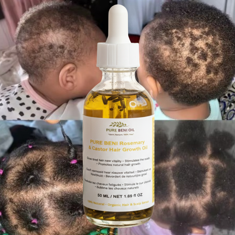 "PURE BÉNI Rosemary & Castor Hair Growth Oil 50ml bottle - natural organic hair growth serum for thicker, fuller hair"