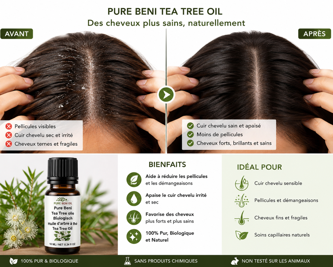 Avant après utilisation de PURE BENI Tea Tree Oil sur cheveux et cuir chevelu montrant une amélioration des pellicules, du cuir chevelu sec et de la santé capillaire.